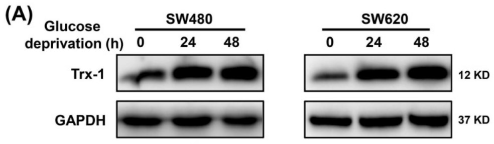 Protein expression of Trx-1 was detected by Western blot analysis.jpg